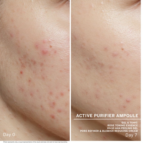 Active Purifier